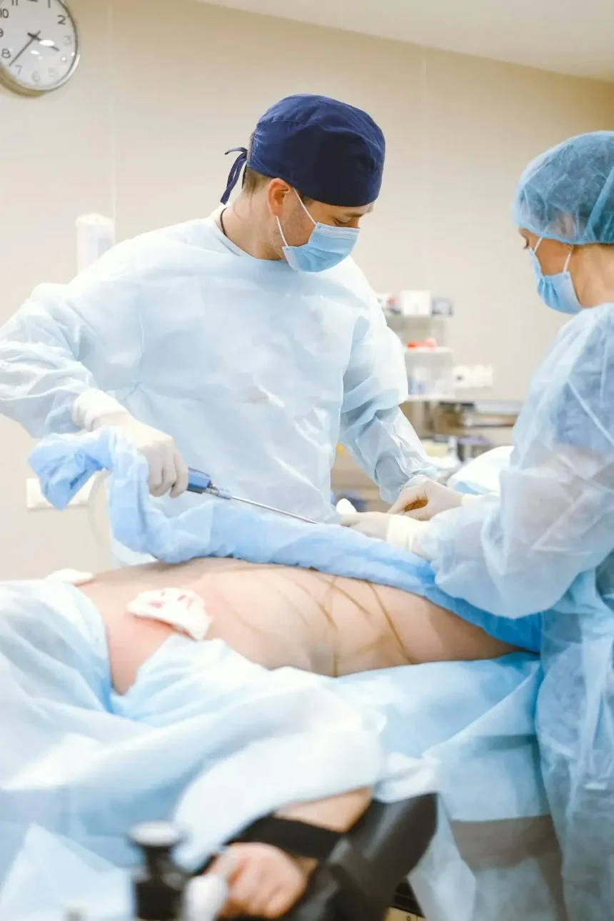 Questions To Ask Your Surgeon Before an Abdominoplasty