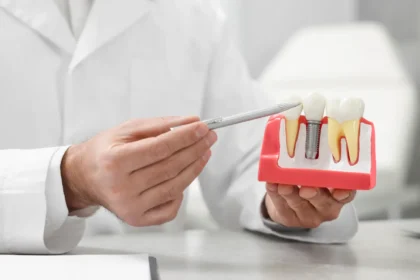 dental implants in Reading