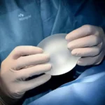 Effective Recovery Strategies After Plastic Surgery
