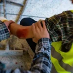 What Should Injured Workers Know Before Filing a Compensation Claim